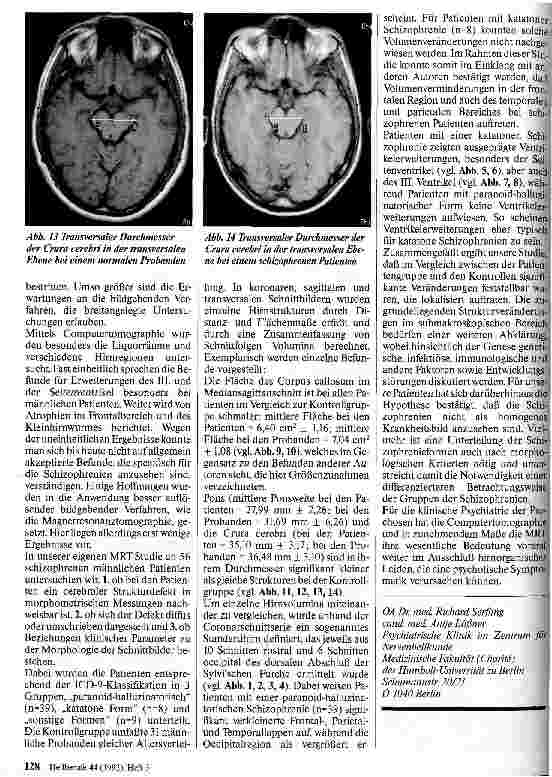 Vorschauseite 5: MR-Bildgebung in der Psychiatrie