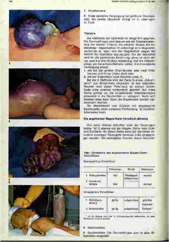 Vorschauseite 2: Chirurgie im Kindesalter II. Teil: Chirurgische Eingriffe im Bauchraum