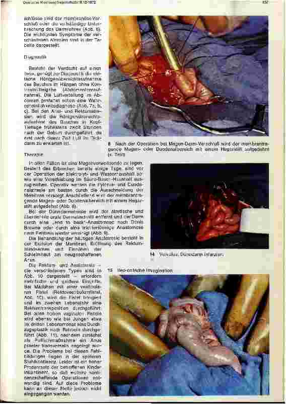Vorschauseite 3: Chirurgie im Kindesalter II. Teil: Chirurgische Eingriffe im Bauchraum