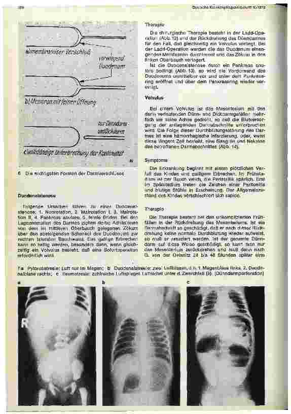 Vorschauseite 4: Chirurgie im Kindesalter II. Teil: Chirurgische Eingriffe im Bauchraum
