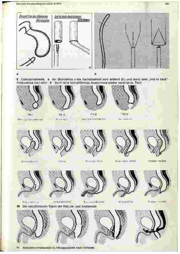Vorschauseite 5: Chirurgie im Kindesalter II. Teil: Chirurgische Eingriffe im Bauchraum