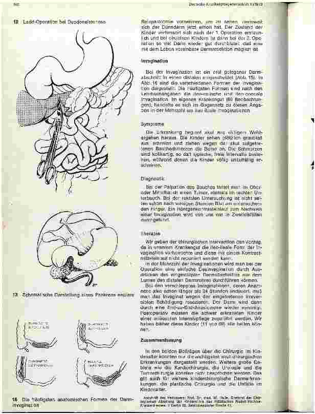 Vorschauseite 6: Chirurgie im Kindesalter II. Teil: Chirurgische Eingriffe im Bauchraum