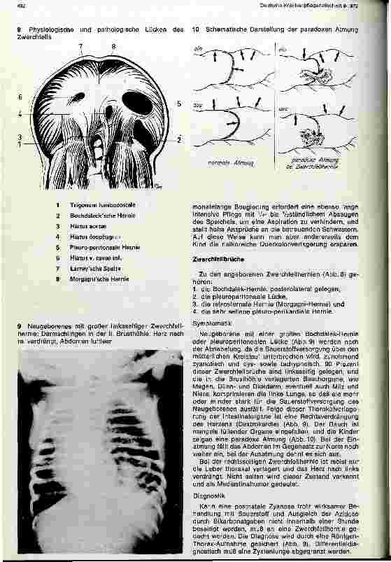 Vorschauseite 4: Chirurgie im Kindesalter Teil I: Thoraxchirurgie