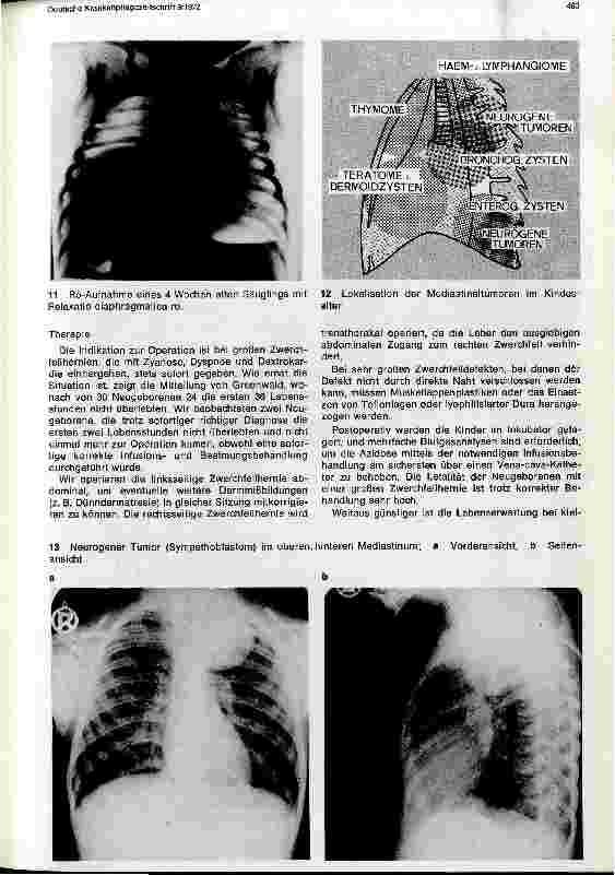 Vorschauseite 5: Chirurgie im Kindesalter Teil I: Thoraxchirurgie