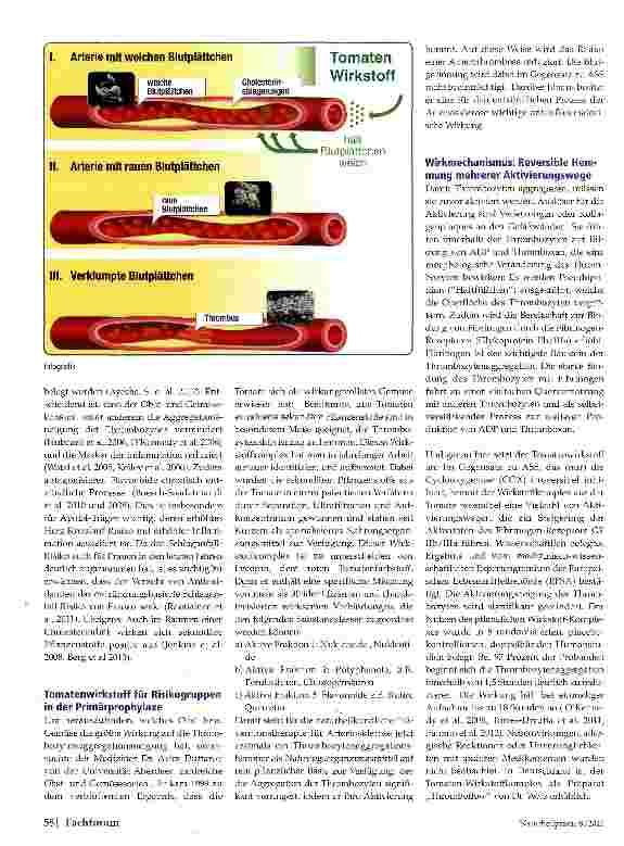 Vorschauseite 2: Arteriosklerose und Thrombosegefahr