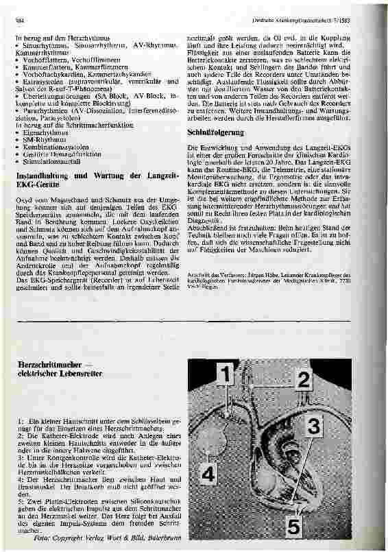 Vorschauseite 3: Das Langzeit-Elektrokardiogramm