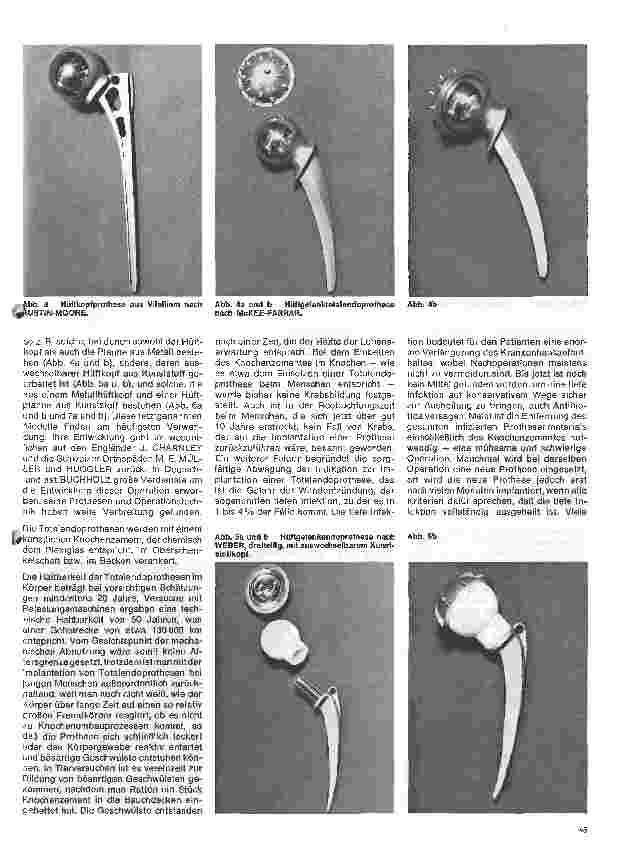 Vorschauseite 2: Moderne Entwicklung in der Orthopädie 2.Folge: Das künstliche Hüftgelenk