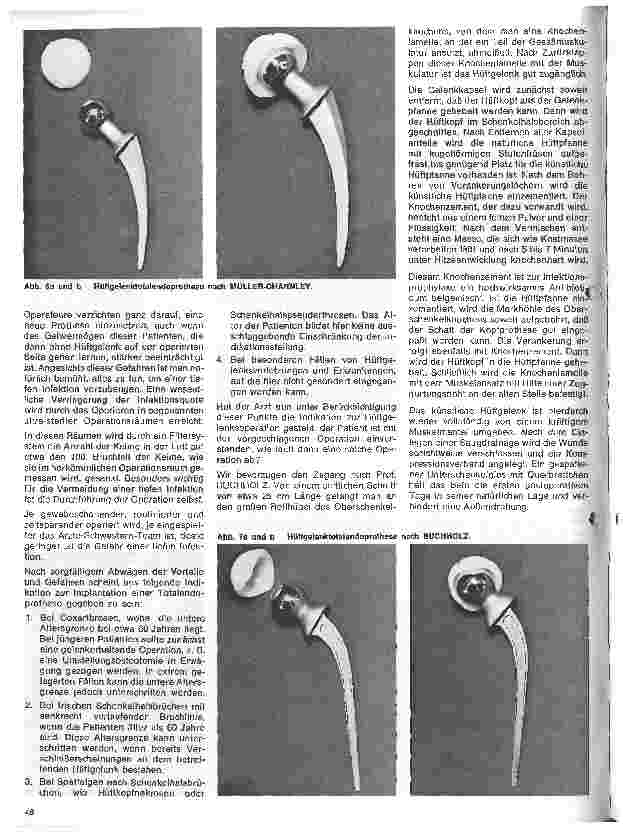 Vorschauseite 3: Moderne Entwicklung in der Orthopädie 2.Folge: Das künstliche Hüftgelenk