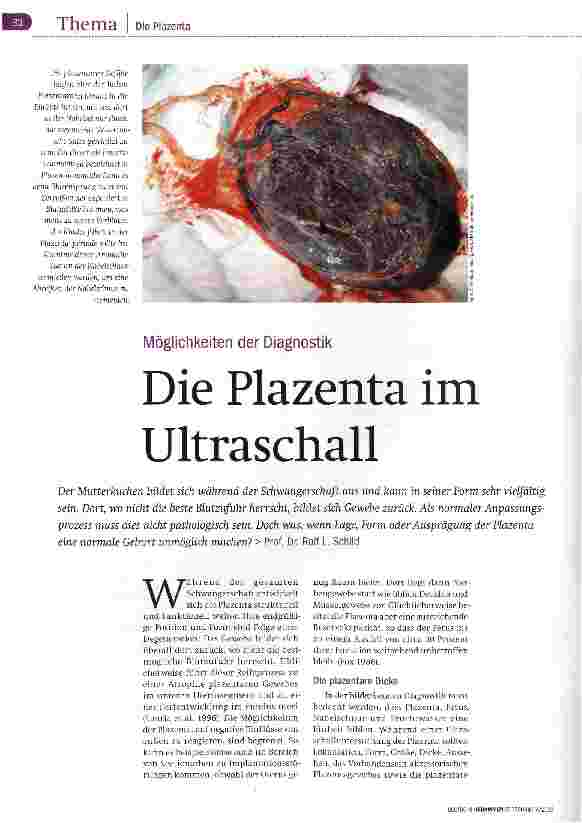 Vorschauseite 1: Die Plazenta im Ultraschall