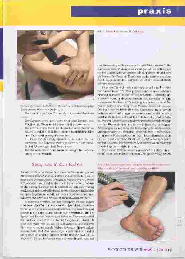 Vorschauseite 2: Die Sprayund Stretch-Technik Cryo-Kaltlufttherapie