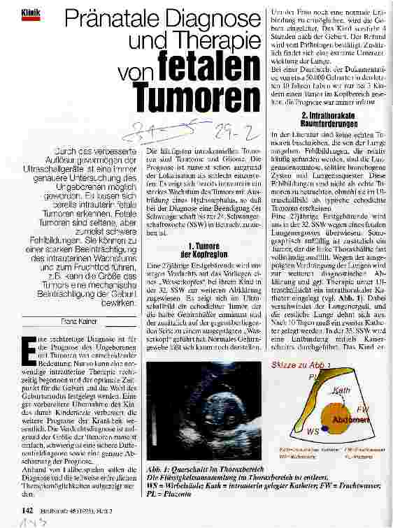 Vorschauseite 1: Pränatale Diagnose und Therapie von fetalen Tumoren