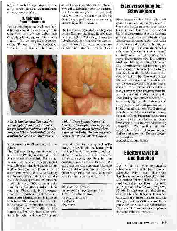 Vorschauseite 2: Pränatale Diagnose und Therapie von fetalen Tumoren