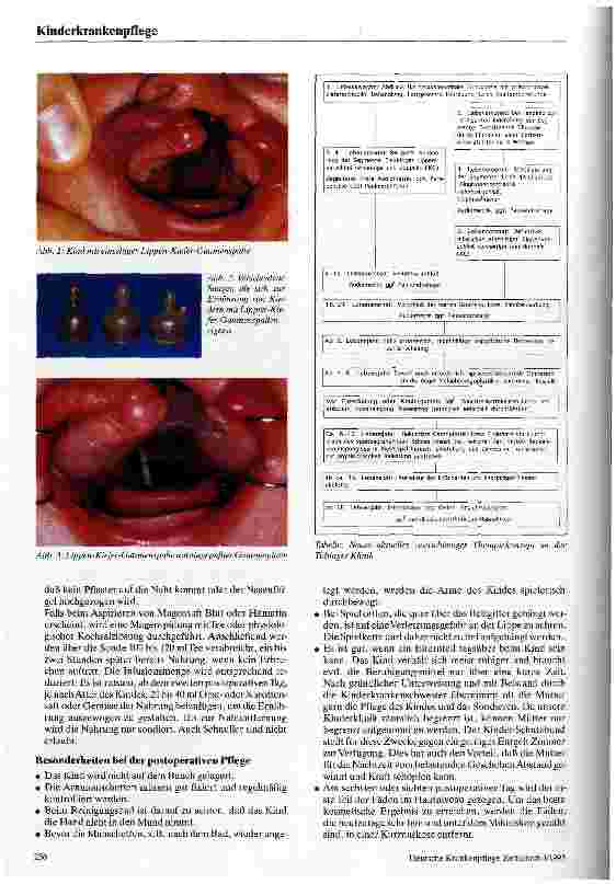 Vorschauseite 2: Pflege eines Kindes mit Lippen-Kiefer-Gaumenspalte
