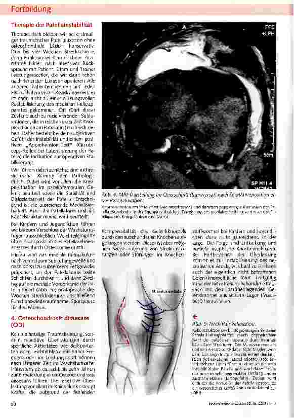 Vorschauseite 4: Das dicke Knie aus kinderorthopädischer Sichtmechanische und funktionelle Störungen