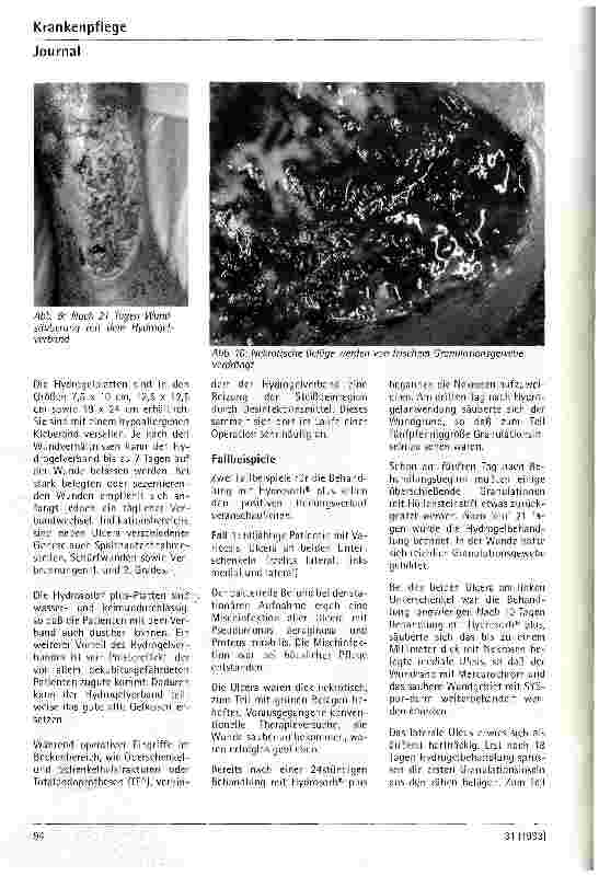 Vorschauseite 3: Volle Durchsicht (Abt.Chirurgie,Kreiskrankenhaus Leonberg) Erfahrungsbericht über die Anwendung von Hydrosorb plus