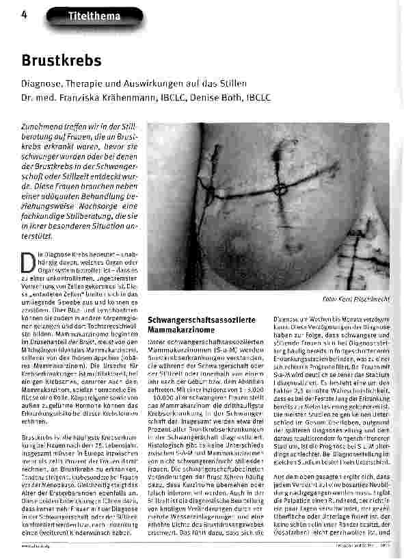 Vorschauseite 1: Brustkrebs