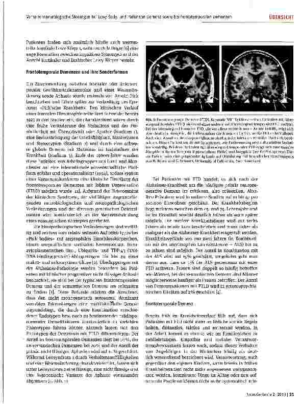 Vorschauseite 5: Verhaltensneurologische Störungen bei Lewy-Bodyund Parkinson-Demenz sowie bei frontotemporalen Demenzen
