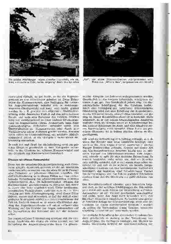 Vorschauseite 2: Das Glaukom