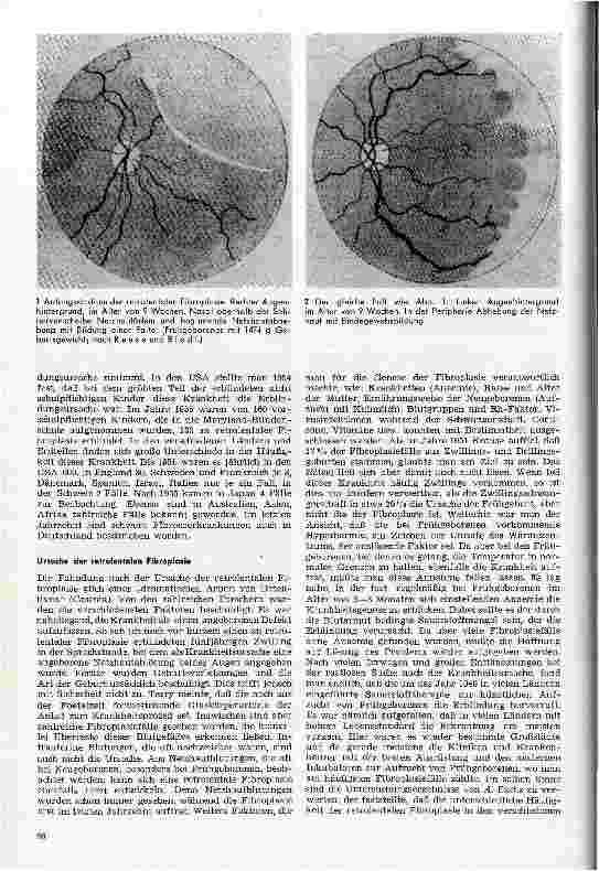Vorschauseite 2: Die retrolentale Fibroplasie