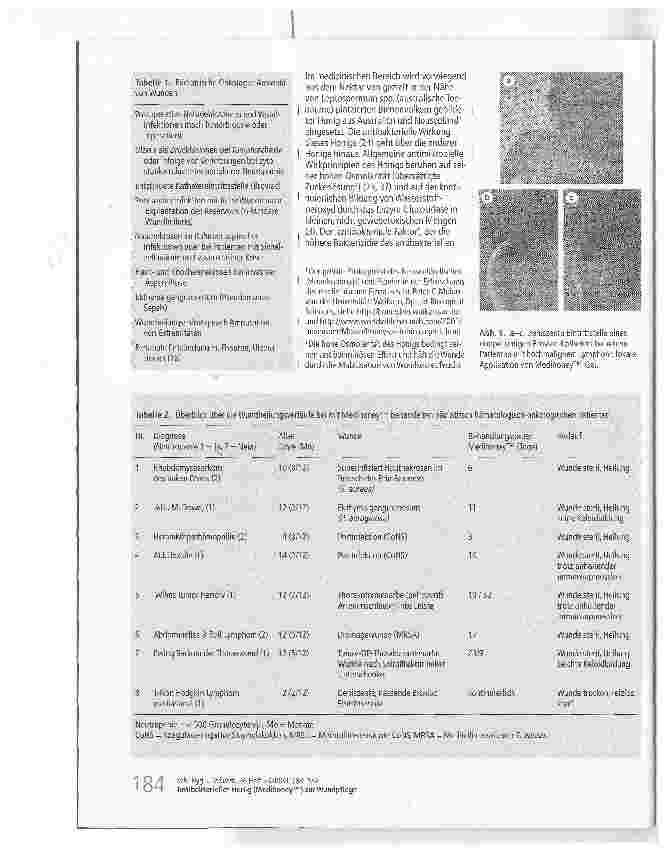Vorschauseite 2: Antibakterieller Honig (Medihoney™) zur Wundpflege Wundantisepsis bei pädiatrischen Patienten in der Hämatologie-Onkologie?
