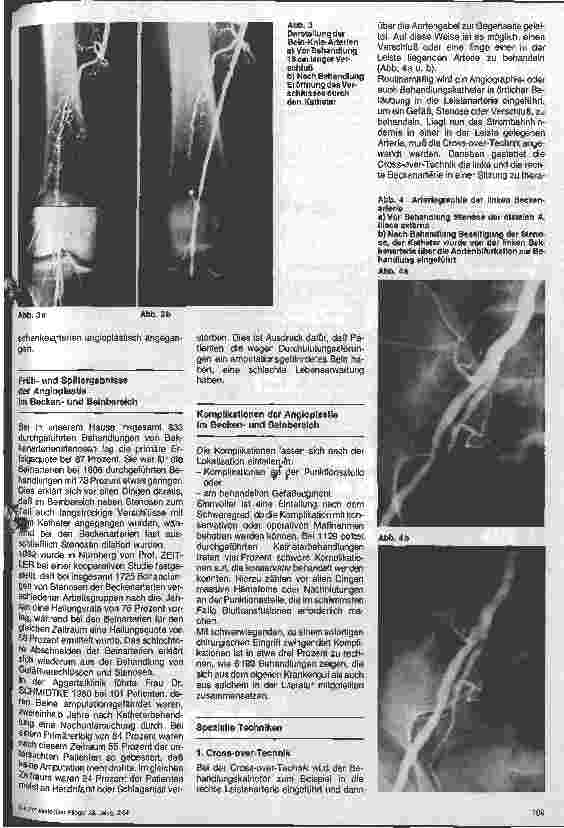 Vorschauseite 3: Gefäßkrankheiten/Die Angioplastie, eine moderne Katheterbehandlung bei der arteriellen Verschlußkrankheit