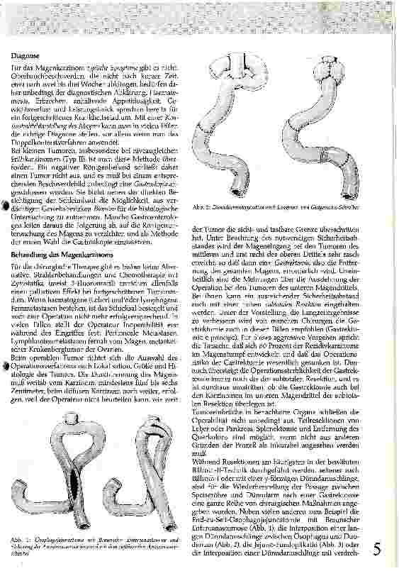 Vorschauseite 2: Klinik und Therapie des Magenkarzinoms