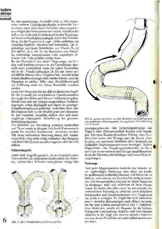 Vorschauseite 3: Klinik und Therapie des Magenkarzinoms