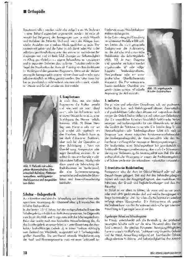 Vorschauseite 4: Sturzfolge Oberarmfraktur und Schultergelenkersatz