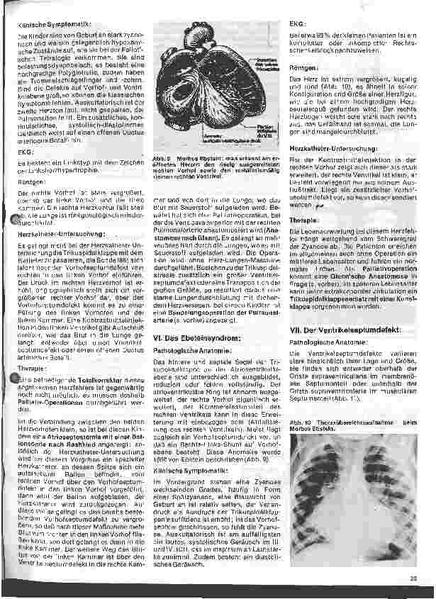 Vorschauseite 4: Das Herz 8. Folge: Angeborene Herzfehler, Klinik u. operative Therapie (I.Teil)