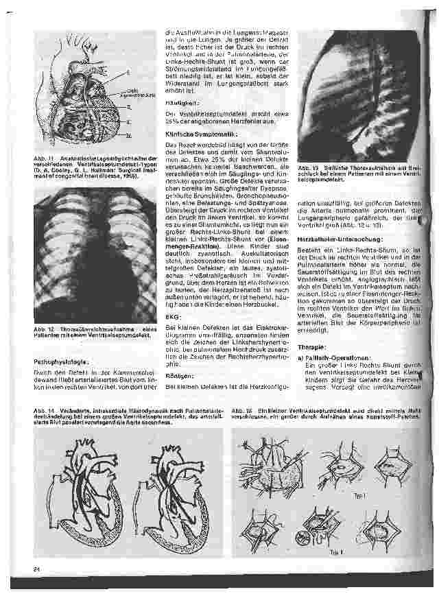 Vorschauseite 5: Das Herz 8. Folge: Angeborene Herzfehler, Klinik u. operative Therapie (I.Teil)