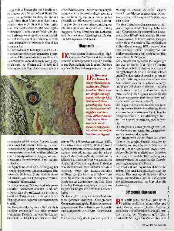 Vorschauseite 2: ZentralNervenSystem-Infektionen im Kindesalter Von der Symptomatik zur Therapie