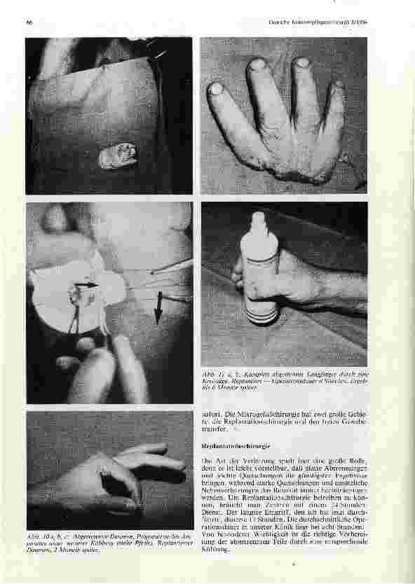 Vorschauseite 5: Die Mikrochirurgie in der Plastischen Chirurgie
