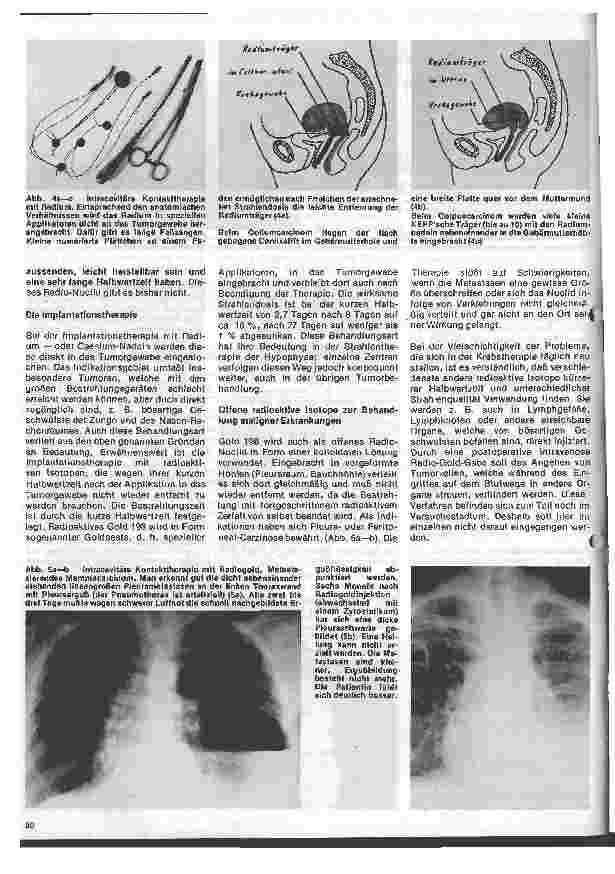 Vorschauseite 3: Radiologie Eine Einführung für Krankenschwestern und Krankenpflegern 15. Folge: Radioaktive Isotope in der Therapie