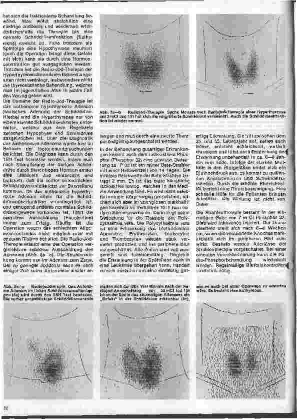 Vorschauseite 5: Radiologie Eine Einführung für Krankenschwestern und Krankenpflegern 15. Folge: Radioaktive Isotope in der Therapie