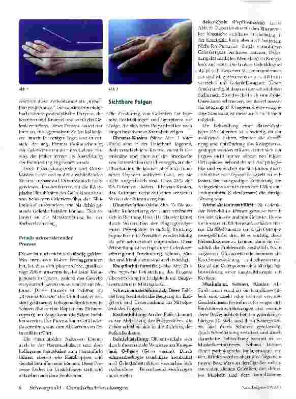 Vorschauseite 3: Rheumatoide Arthritis
