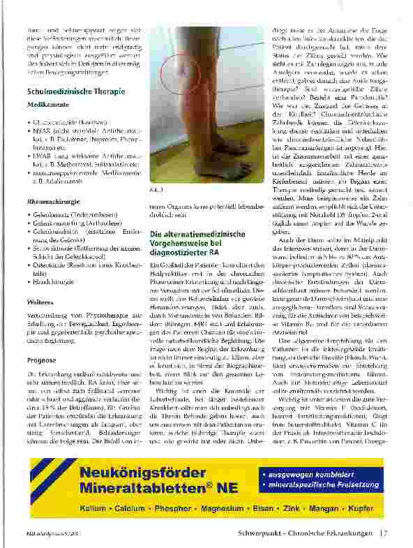 Vorschauseite 4: Rheumatoide Arthritis