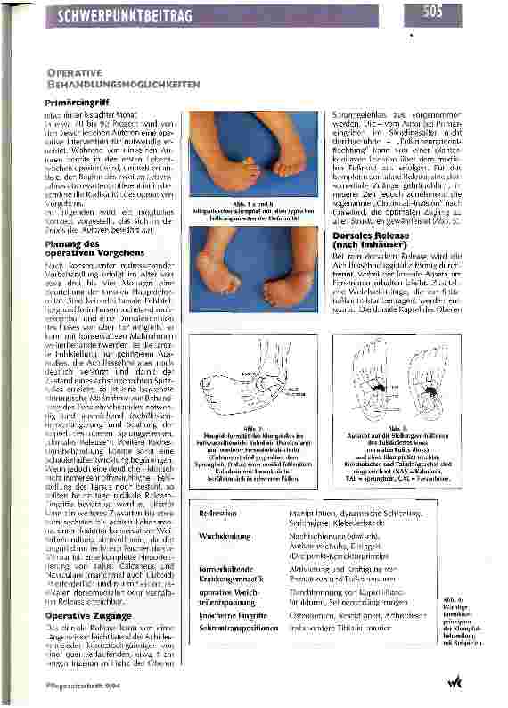 Vorschauseite 2: Die operative Behandlung des idiopathischen Klumpfußes Chirurgisches Vorgehen im Rahmen des orthopädischen Gesamtbehandlungskonzepts
