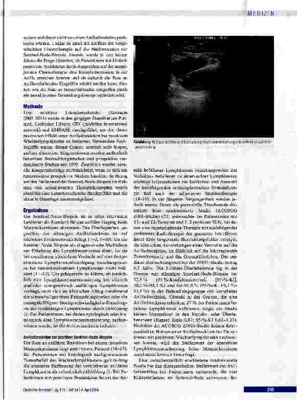 Vorschauseite 2: Sentinel-Node-Biopsie und Axilladissektion beim Mammakarzinom