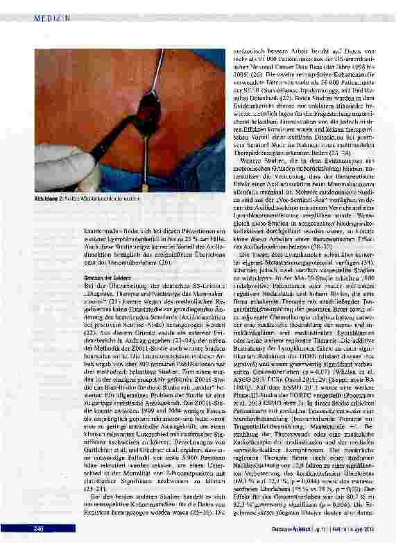 Vorschauseite 3: Sentinel-Node-Biopsie und Axilladissektion beim Mammakarzinom