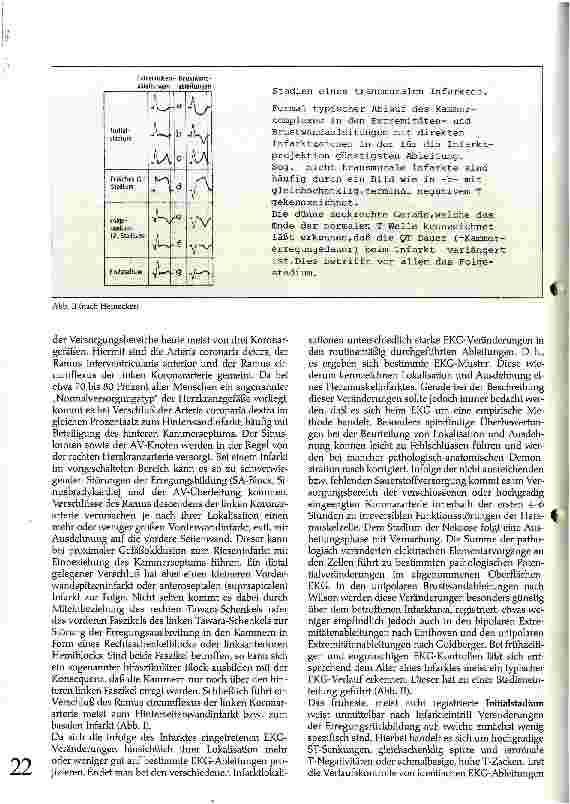 Vorschauseite 2: EKG-Veränderungen beim Herzinfarkt