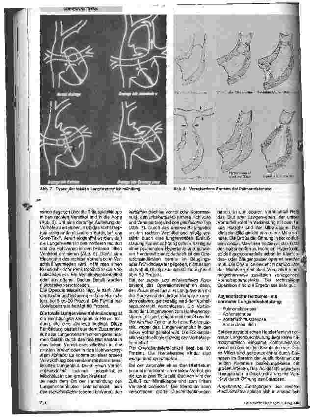 Vorschauseite 3: Angeborene Herzfehler und ihre Therapie