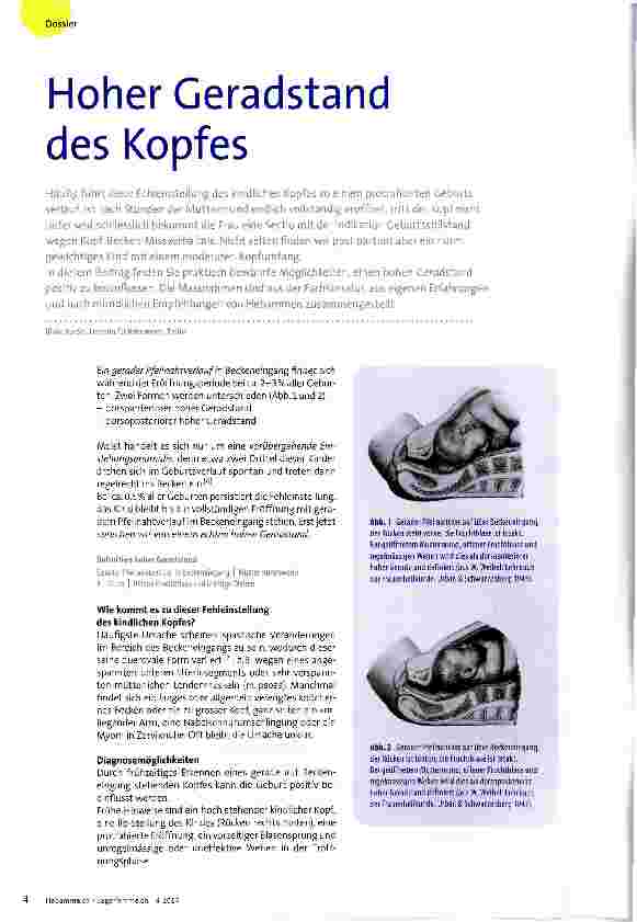 Vorschauseite 1: Hoher Geradstand des Kopfes