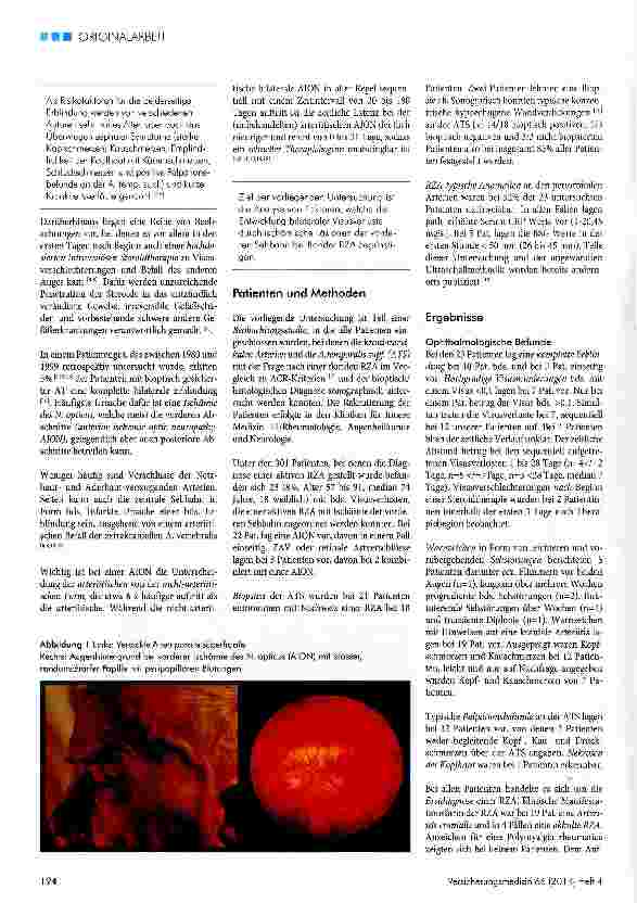 Vorschauseite 2: Bilateraler Visusverlust bei der Arteriitis temporalis eine vermeidbare Komplikation?Beobachtungen an 23 Patienten