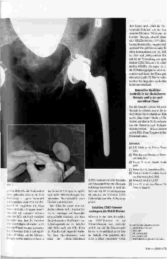Vorschauseite 2: State-of-the-Art der Schmerztherapie in der Orthopädie