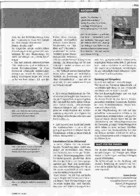 Vorschauseite 2: Stoma und Lebensqualität