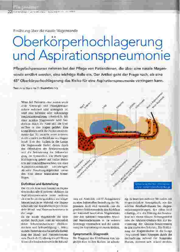 Vorschauseite 1: Oberkörperhochlagerung und Aspirationspneumonie