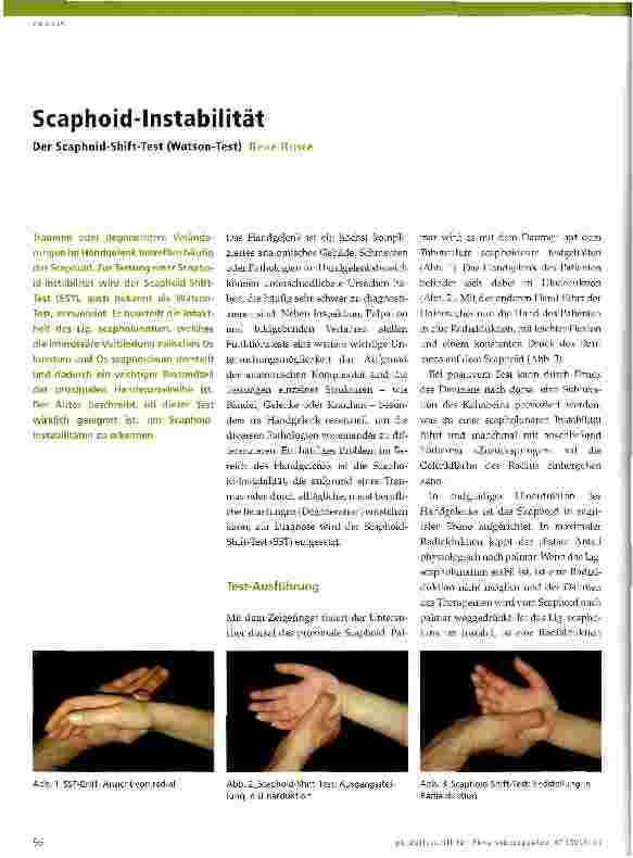 Vorschauseite 1: Scaphoid-Instabilität