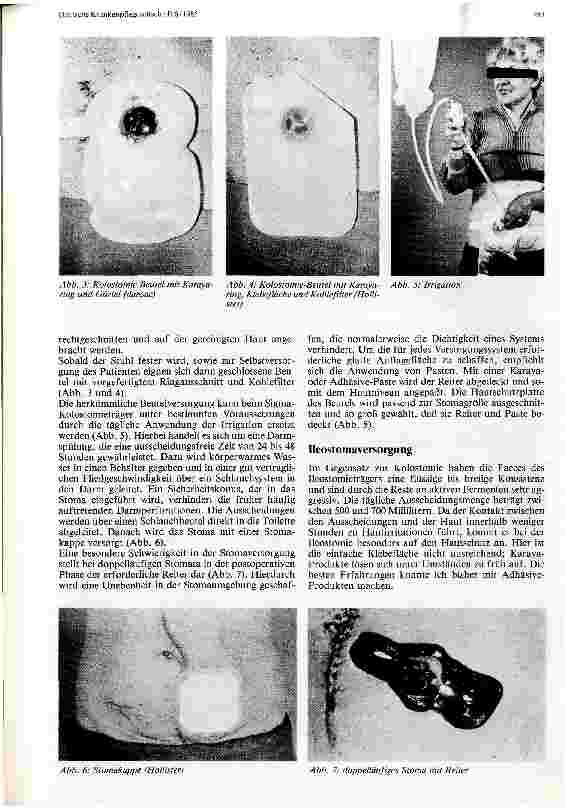 Vorschauseite 3: Versorgung von Kolound Ileostoma