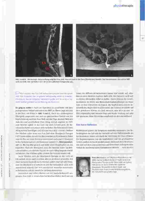 Vorschauseite 4: Löchrige Diagnose