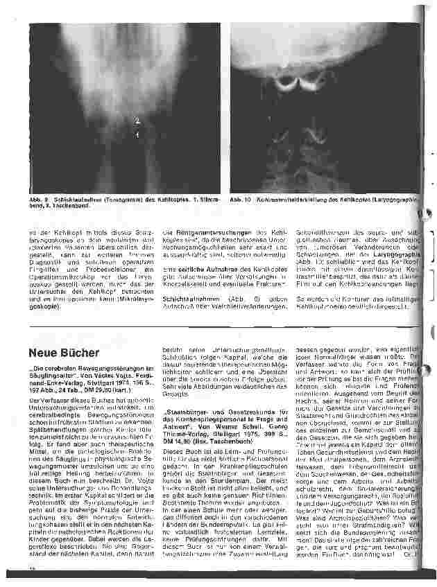 Vorschauseite 5: Einführung in die Hals-Nasen-Ohren-Heilkunde 18.Folge: Der Kehlkopf, Anatomie, Physiologie, Untersuchungsmethoden